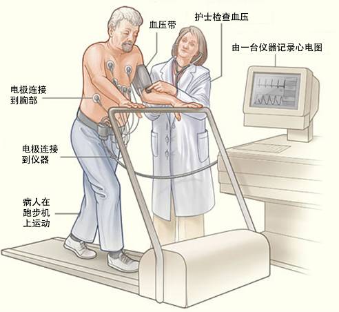 冠心病需要做哪些檢查？(圖3)